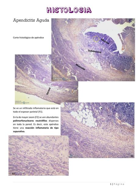 Anatomía Patológica Injuria