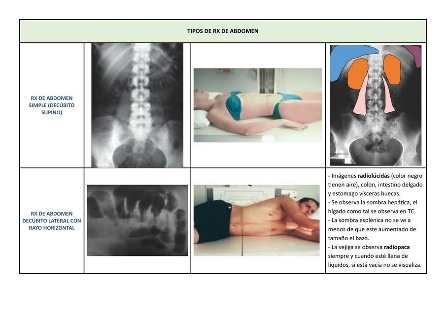 RX abdominal