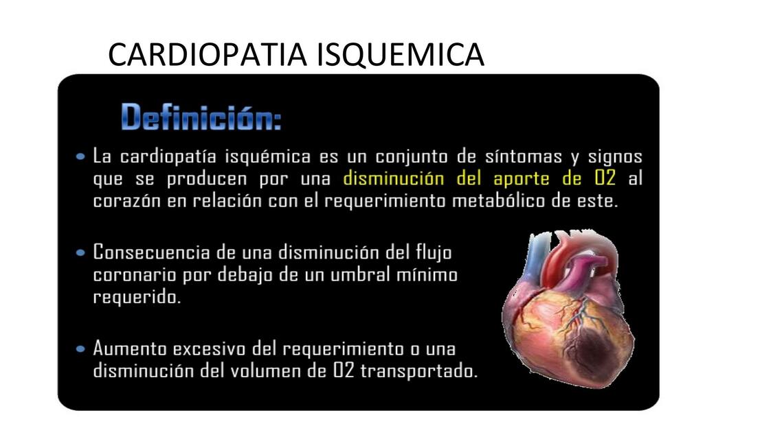 Cardiopatía Isquémica 