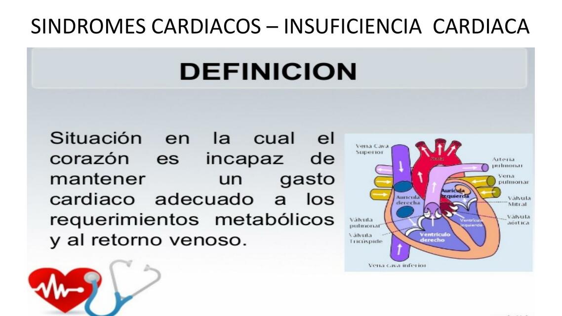 Síndromes Cardiacos- Insuficiencia Cardiaca 