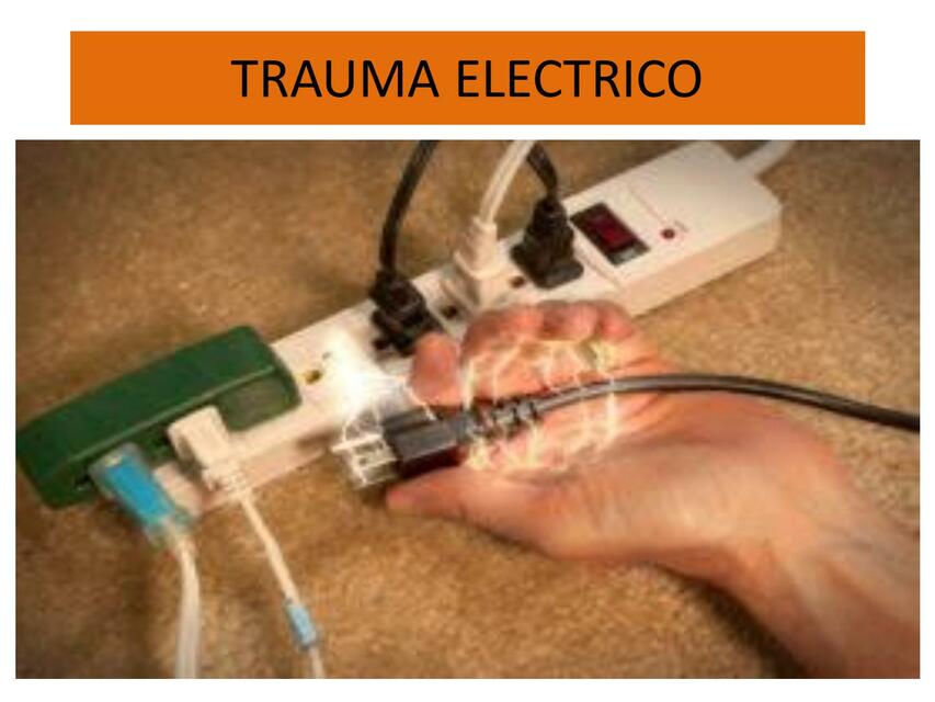 Trauma  Eléctrico  2