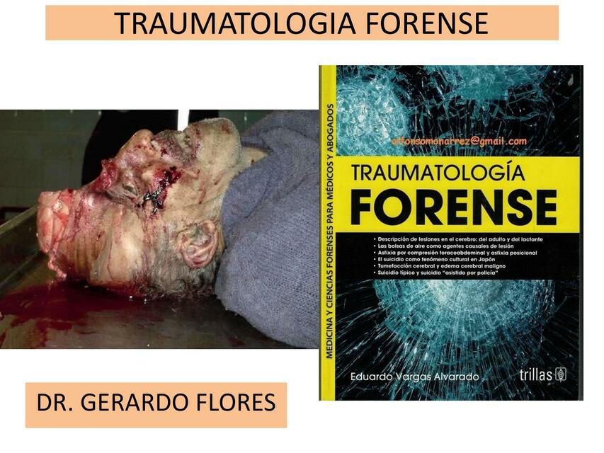 II Parcial Forense 1 45