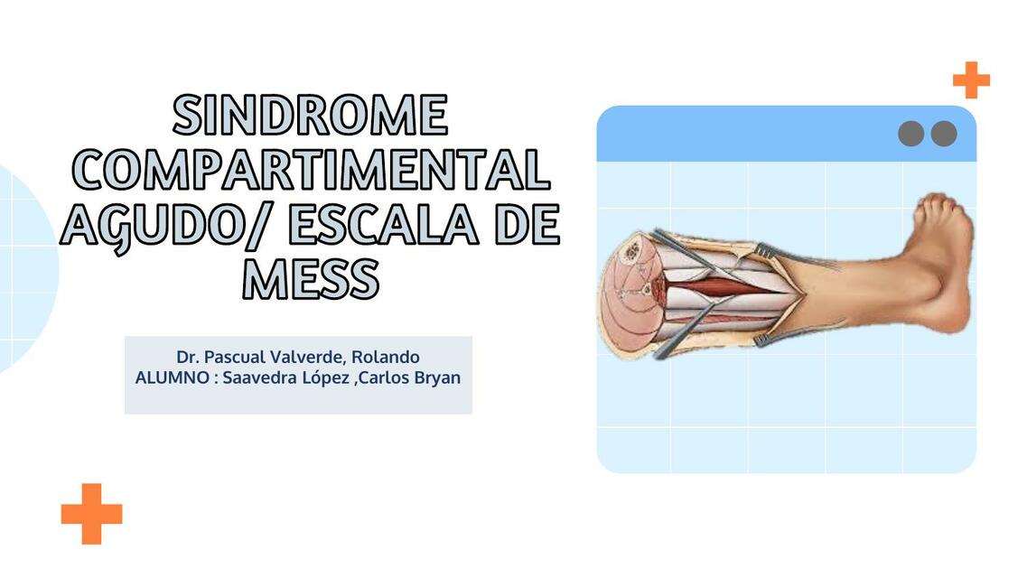 Síndrome Compartimental