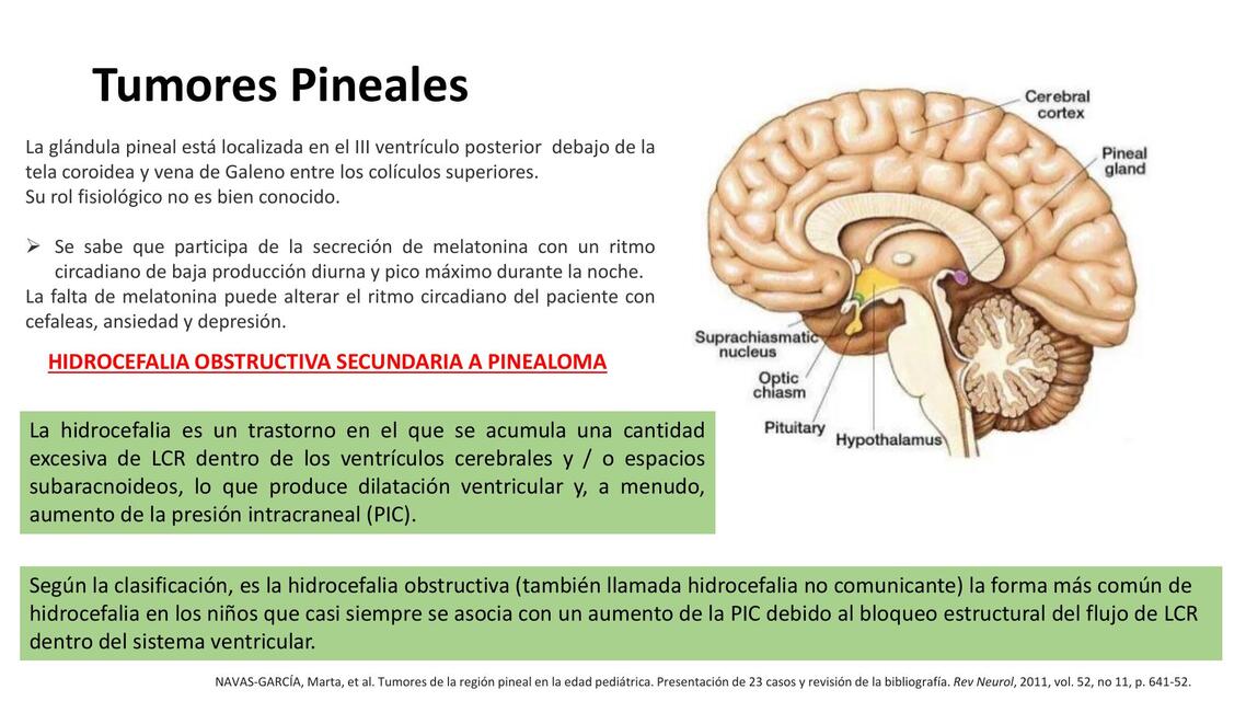 Tumores Pineales