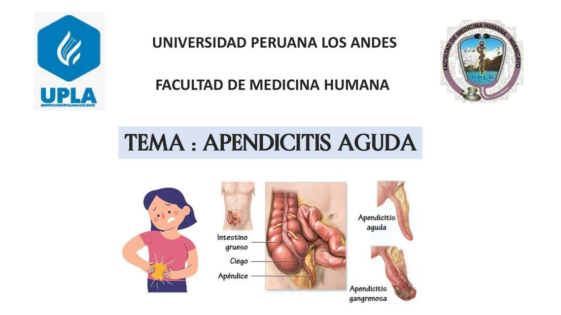 Apendicitis Aguda 