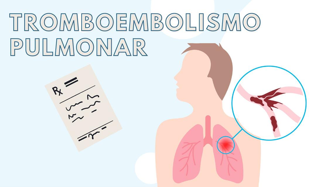 Tromboembolismo pulmonar 