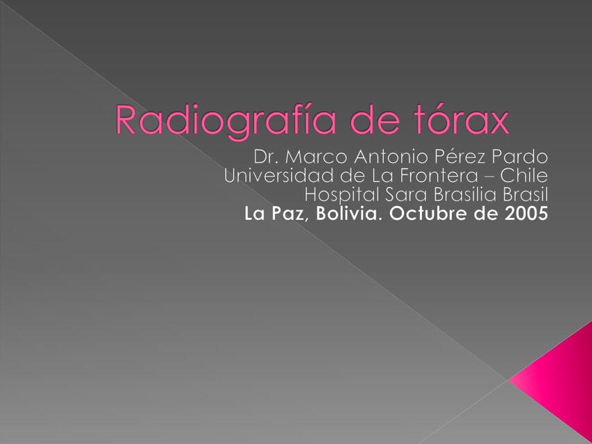 Radiografía de Tórax 