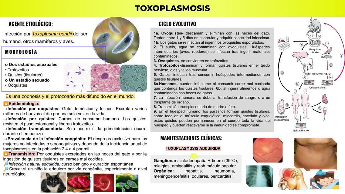 Toxoplasmosis 