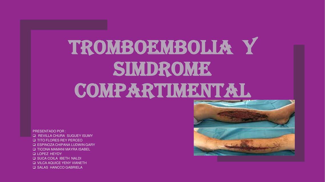 Tromboembolia y Síndrome Compartimental 