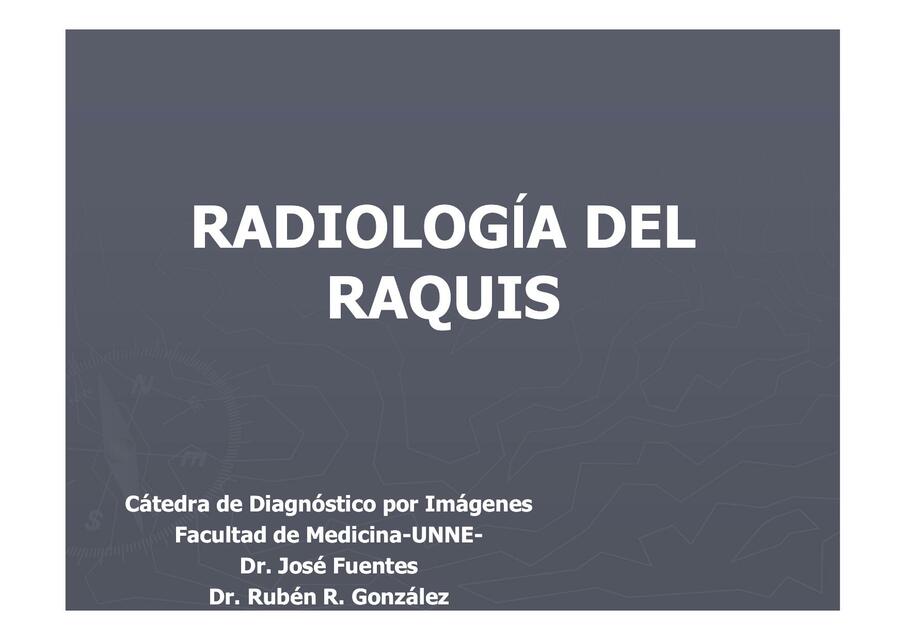 Radiología del Raquis 