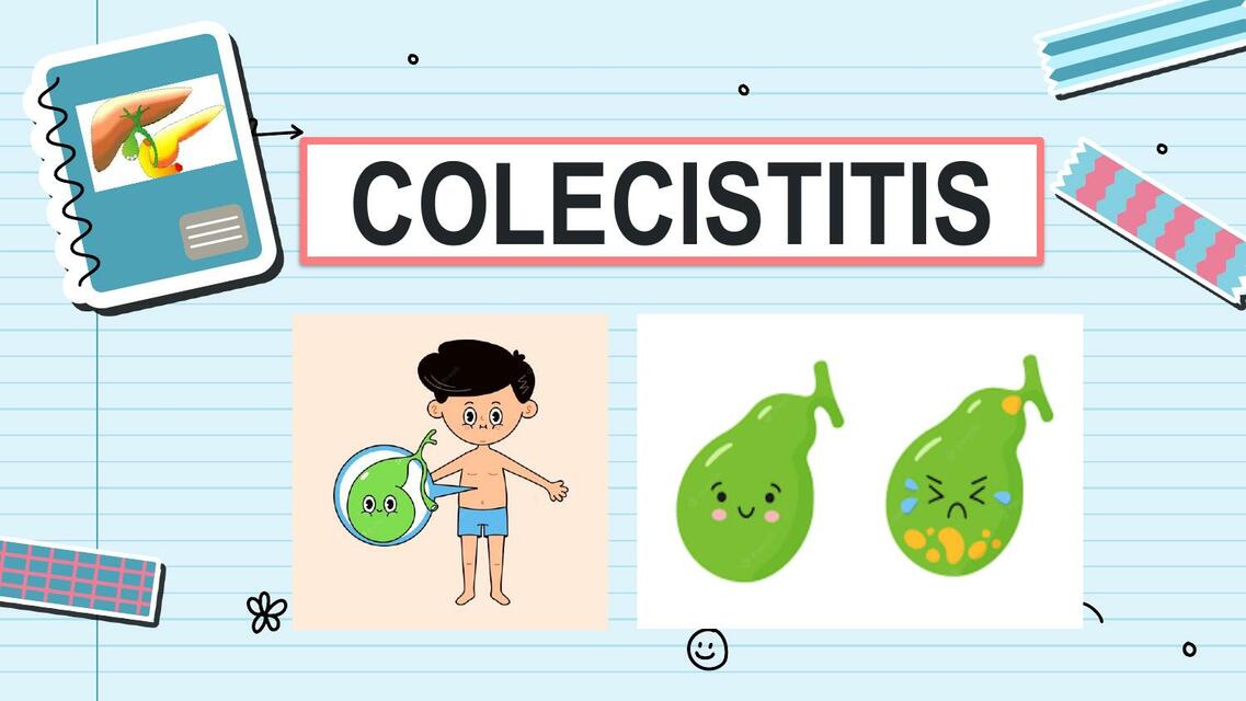 Colecistitis