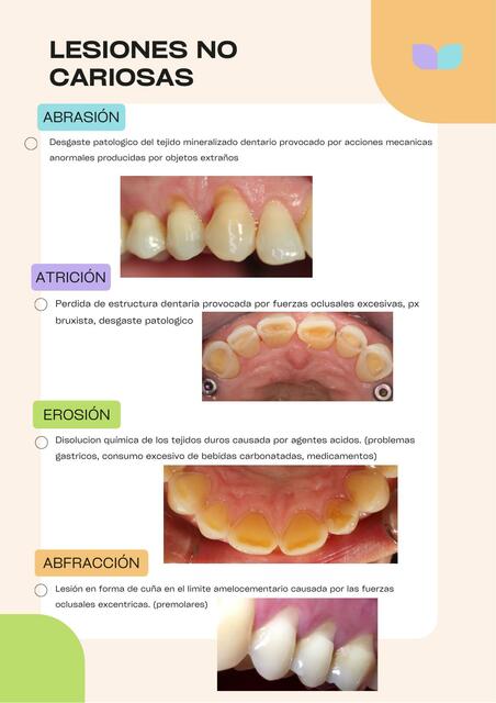 Lesiones no cariosas