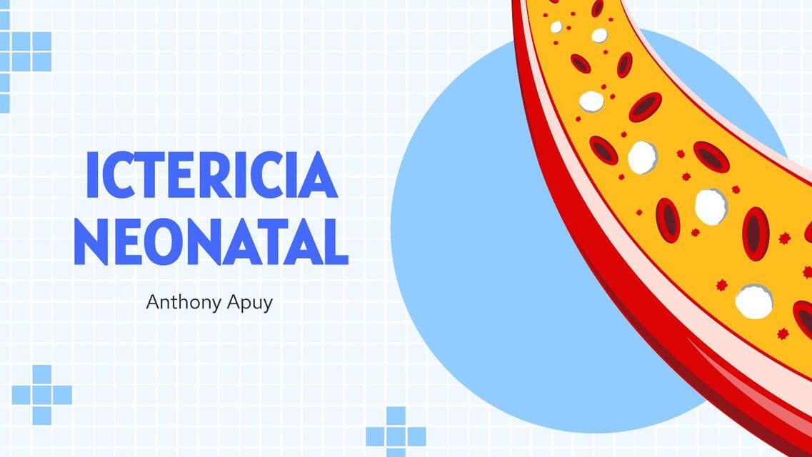 Ictericia Neonatal 