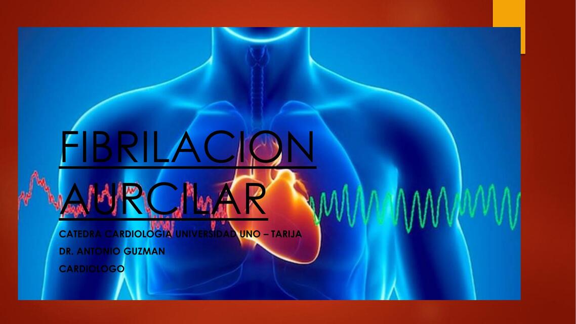 Fibrilación auricular  