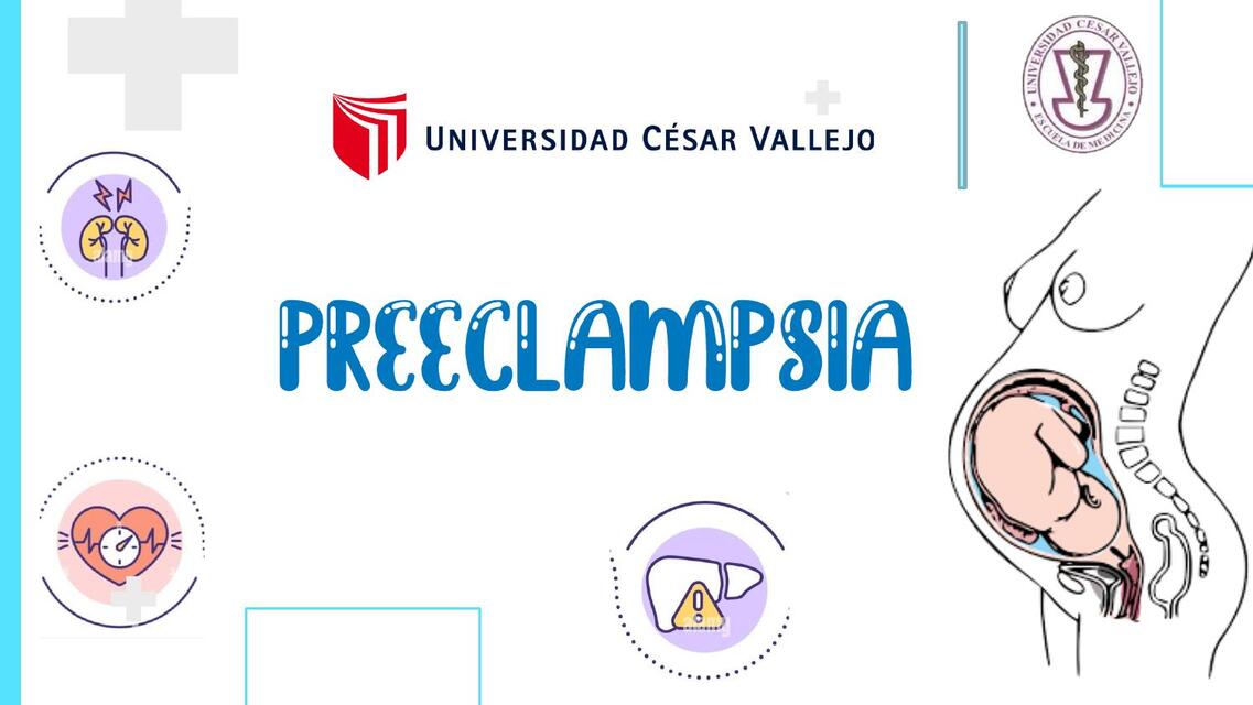 Preeclampsia 