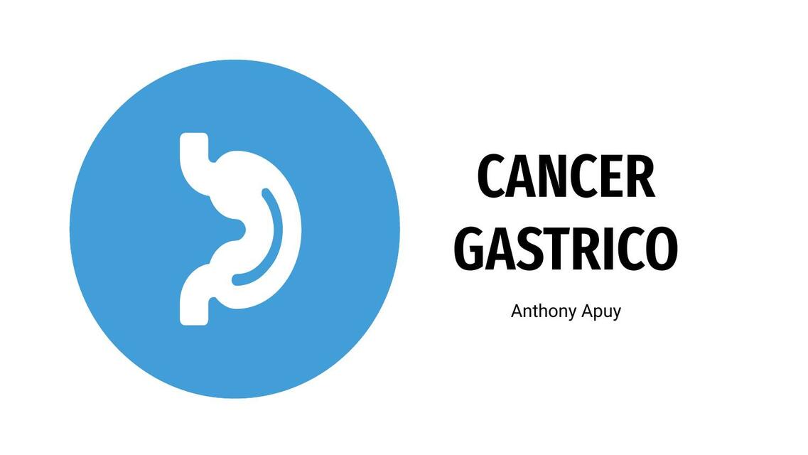 Cáncer Gástrico 