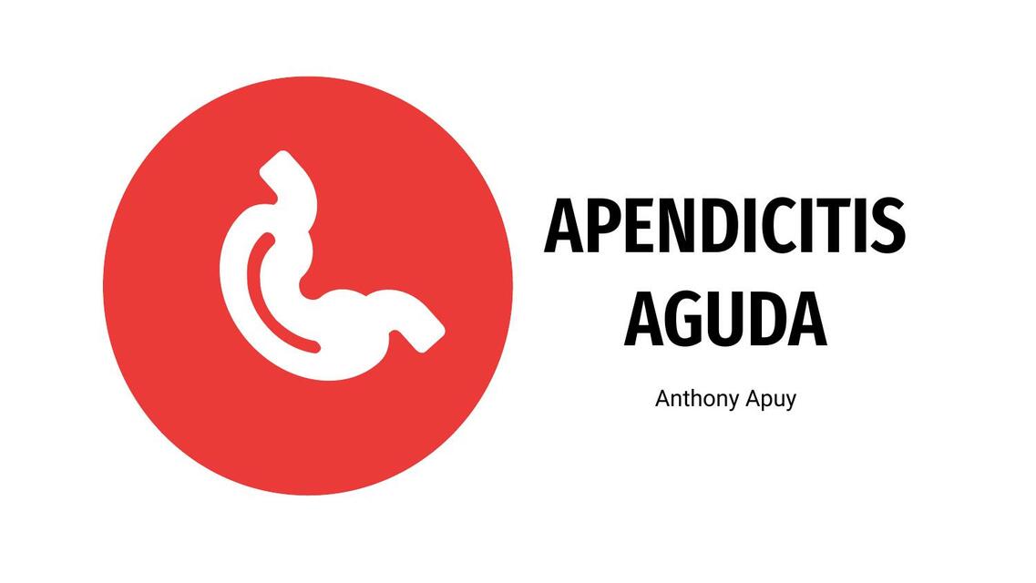 Apendicitis Aguda 