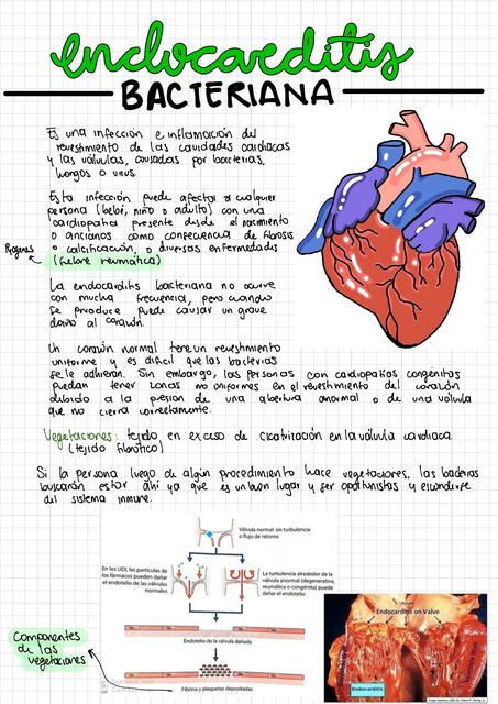 Endocarditis bacteriana