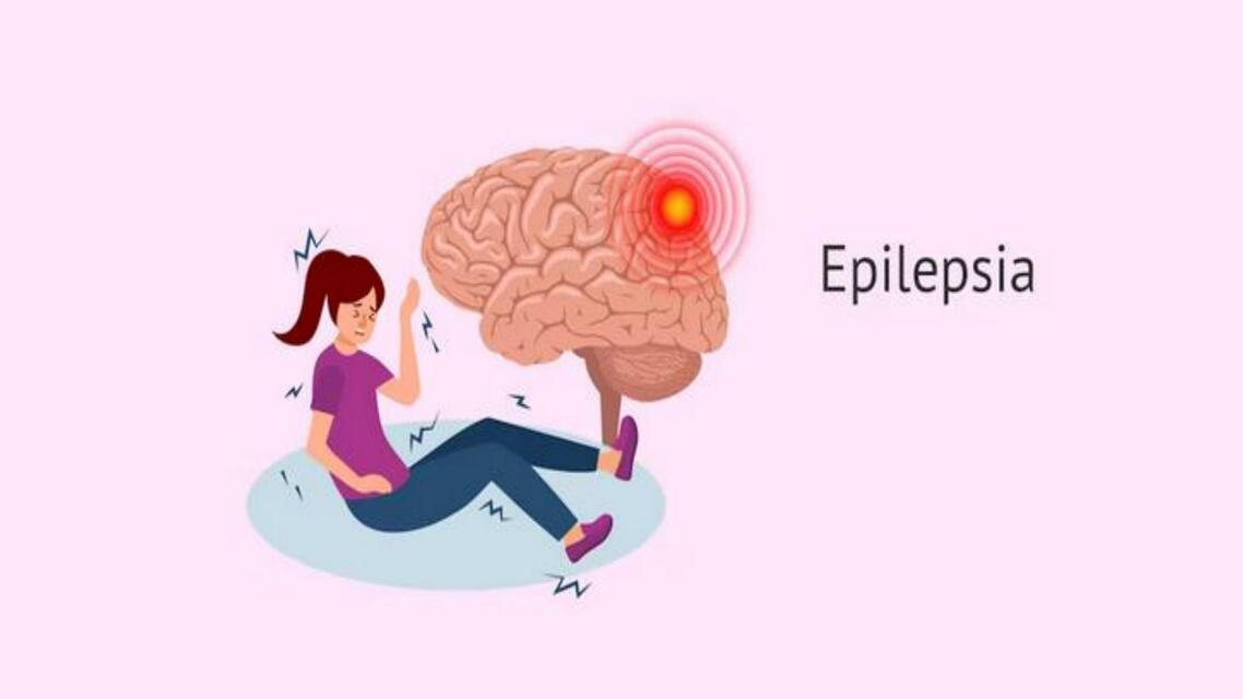 Epilepsia 