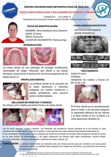 Caso clínico profilaxis y selladores de fosetas y fisuras 