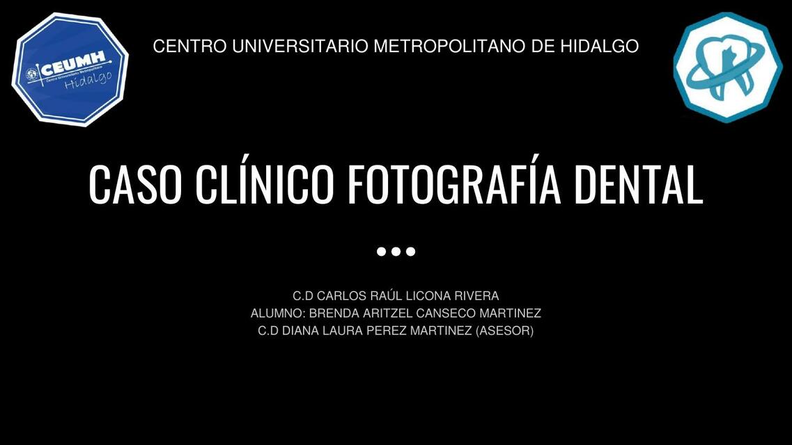 Caso clínico fotografía dental 