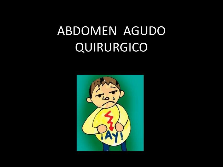 Abdomen Agudo Quirúrgico 