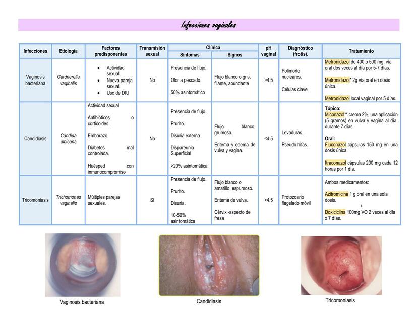 Infecciones Vaginales 