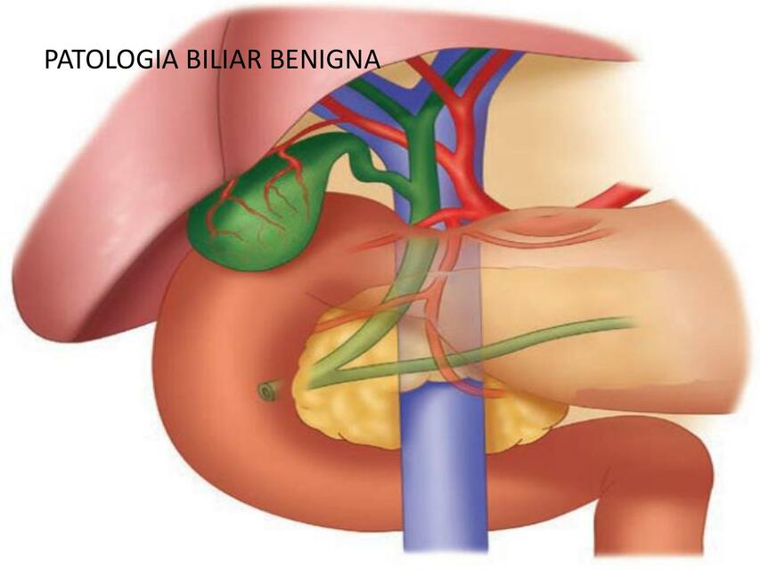 Patología biliar benigna 