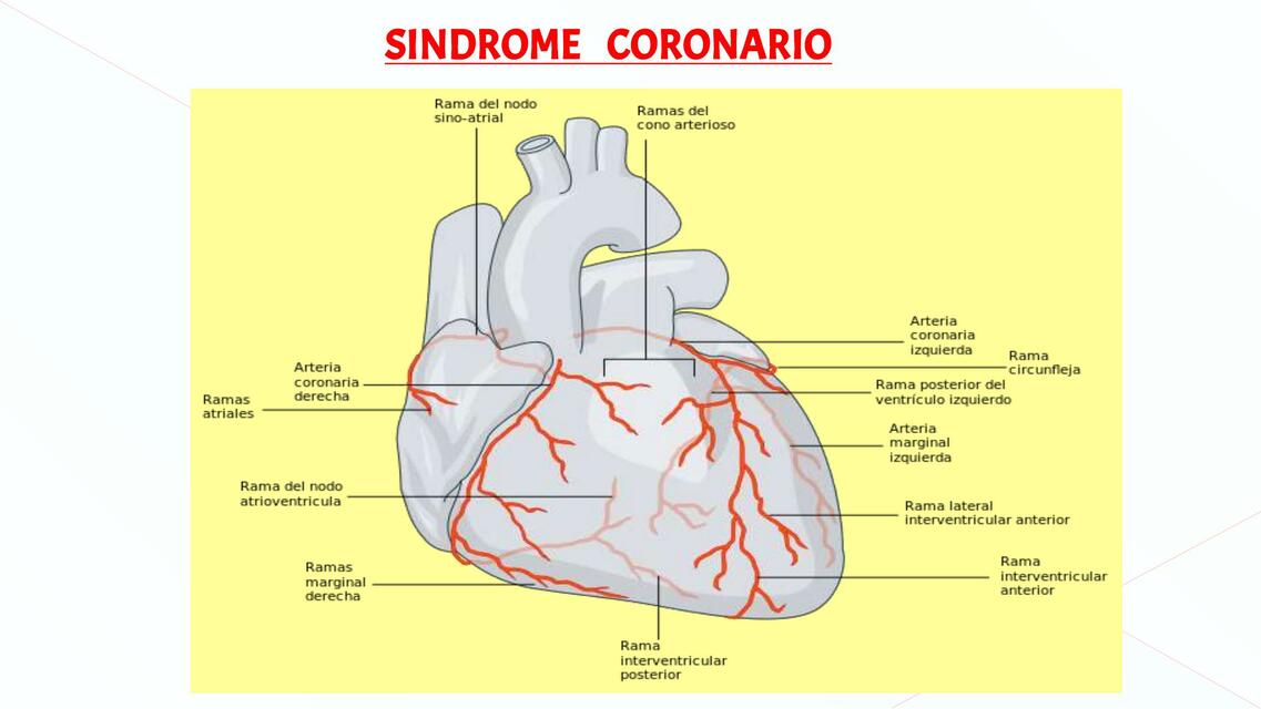 Síndrome Coronario 