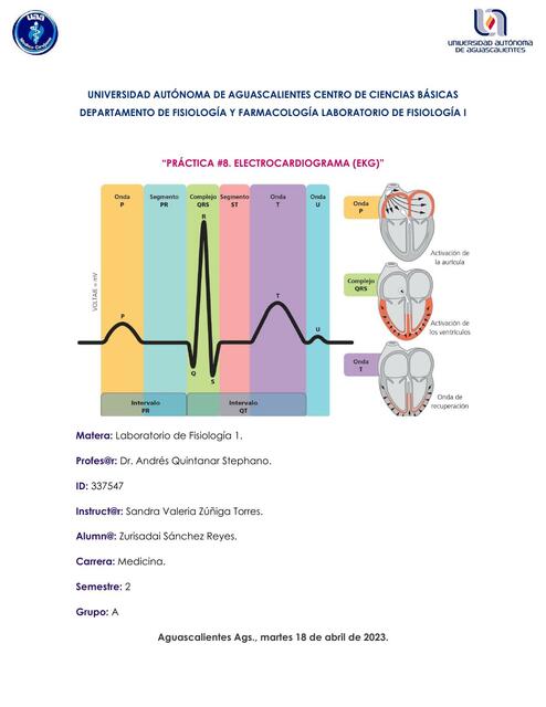 Electrocardiograma 