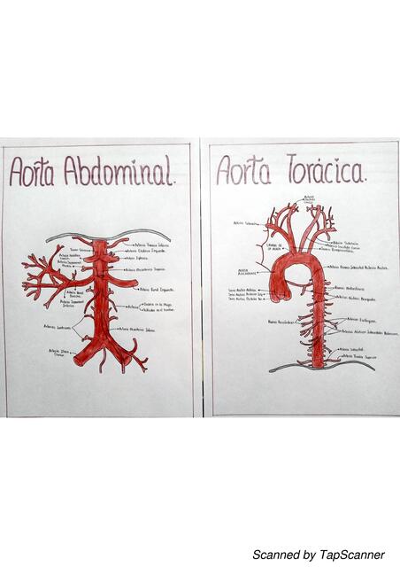 Esquema de Arteria Aorta Abdominal y Torácica 