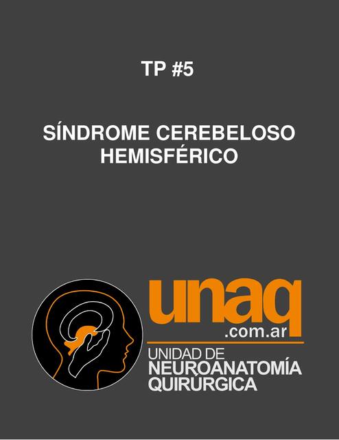 Síndrome Cerebeloso Hemisférico 