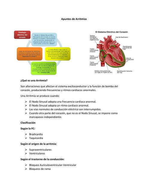 Apuntes de Arritmias 