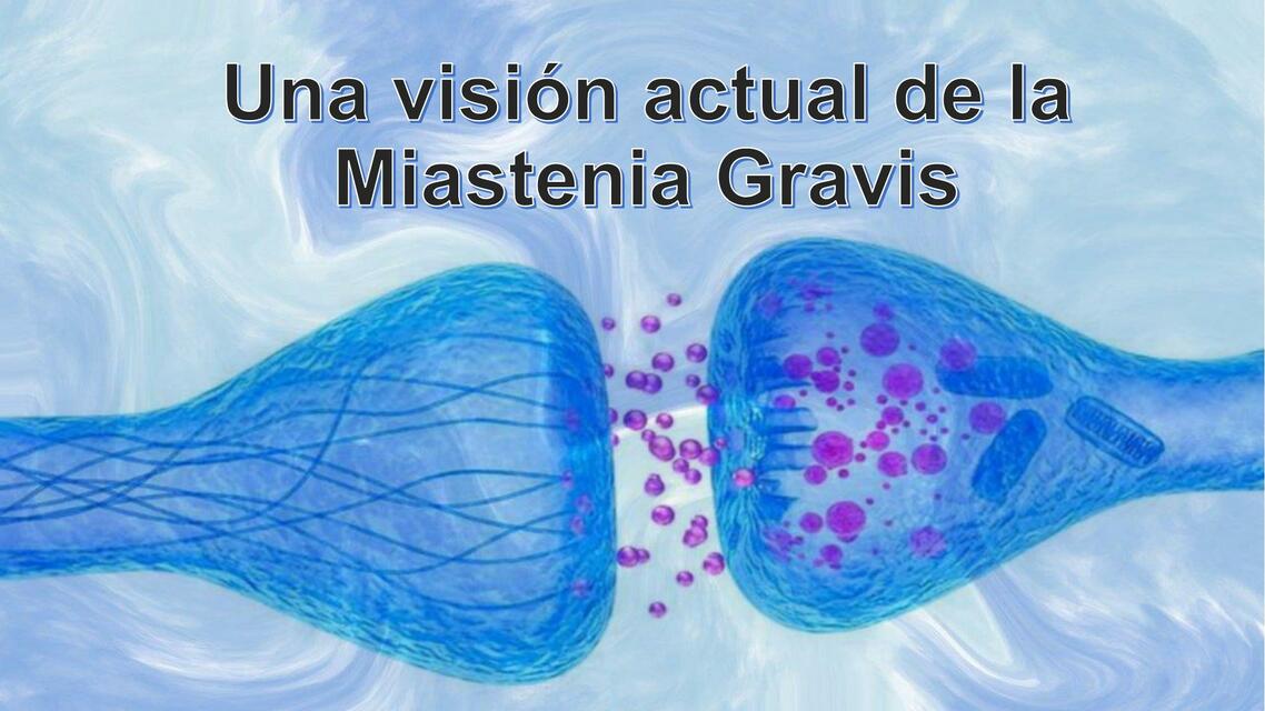 Miastenia Gravis