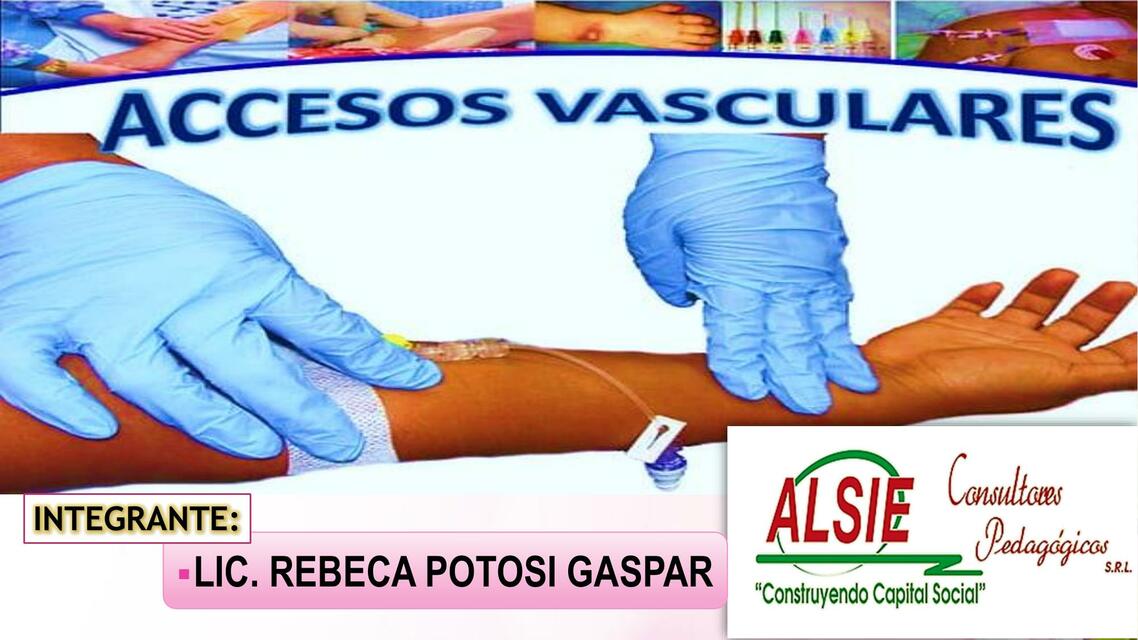 Accesos Vasculares 