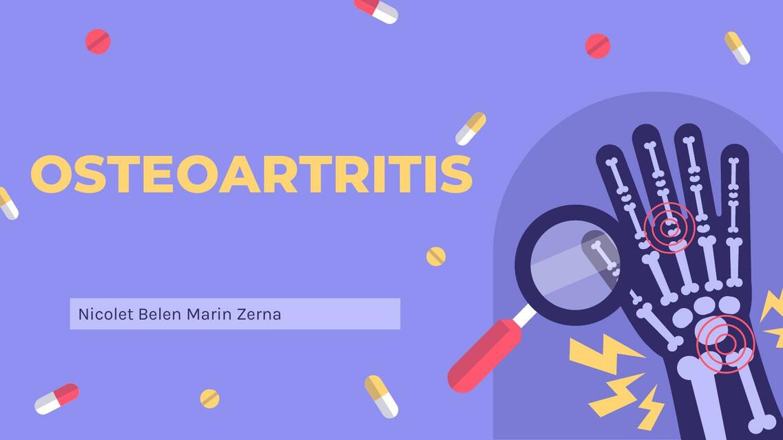 Osteoartritis