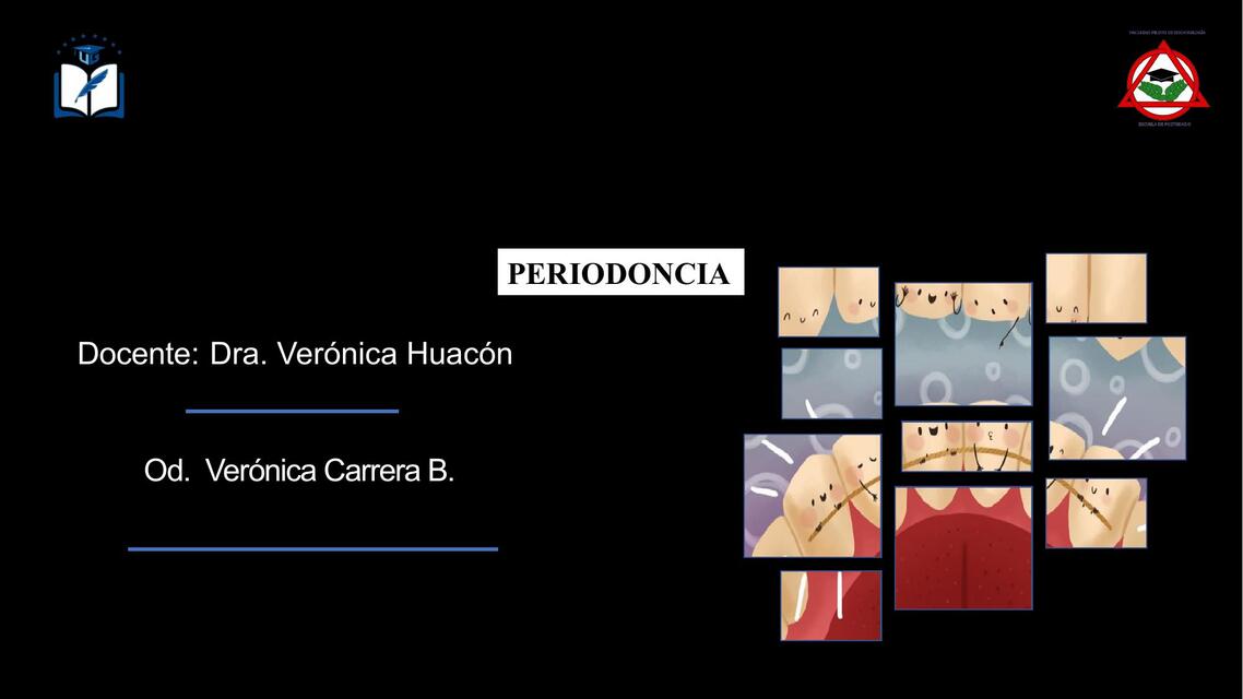 Periodoncia  