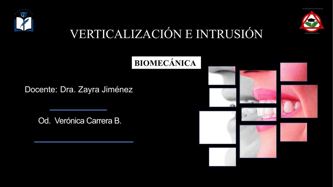 Verticalización e Intrusión Biomecánica 