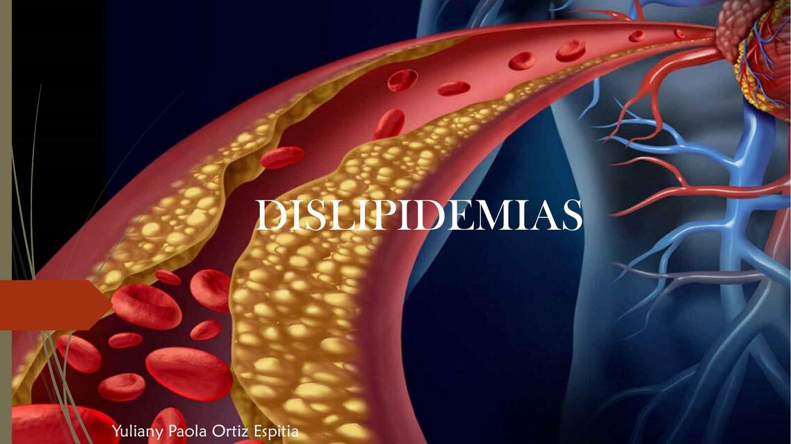 Dislipidemias