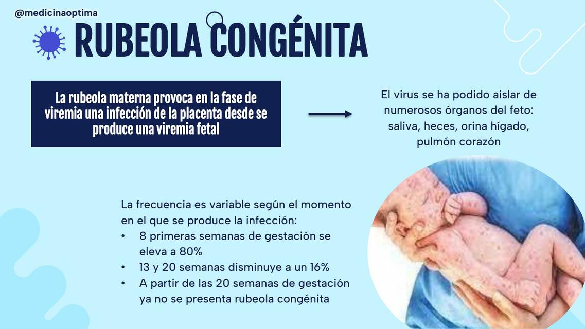 Rubeola congénita | Medicina Óptima | uDocz