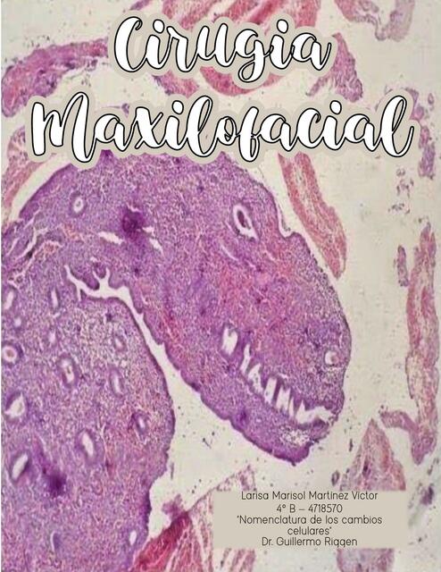 Cirugía maxilofacial 