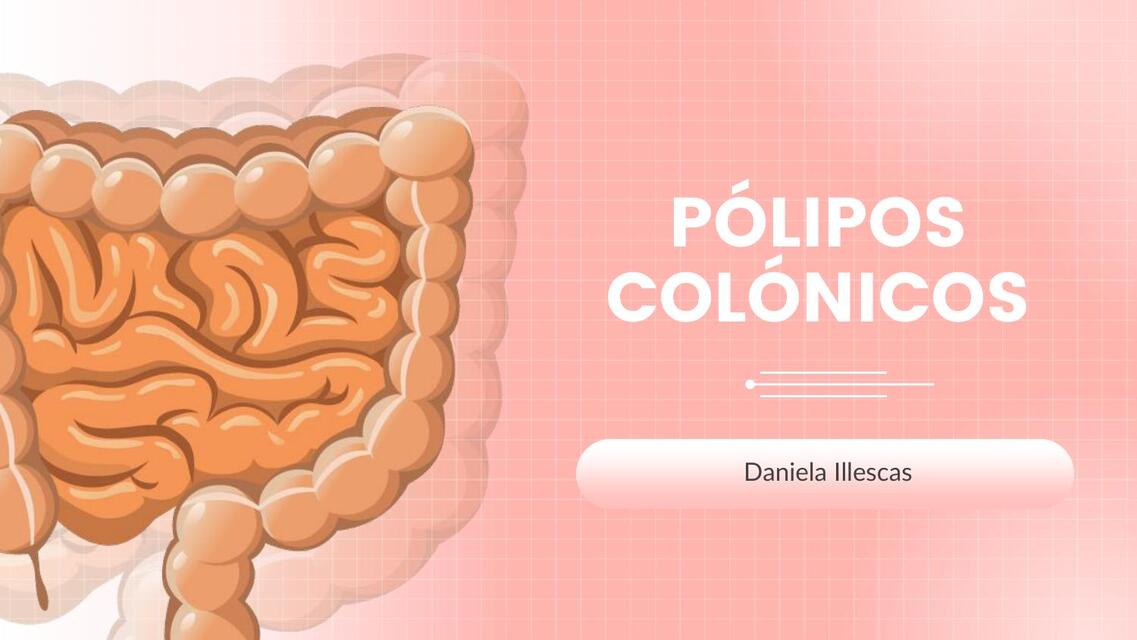 Pólipos colónicos  