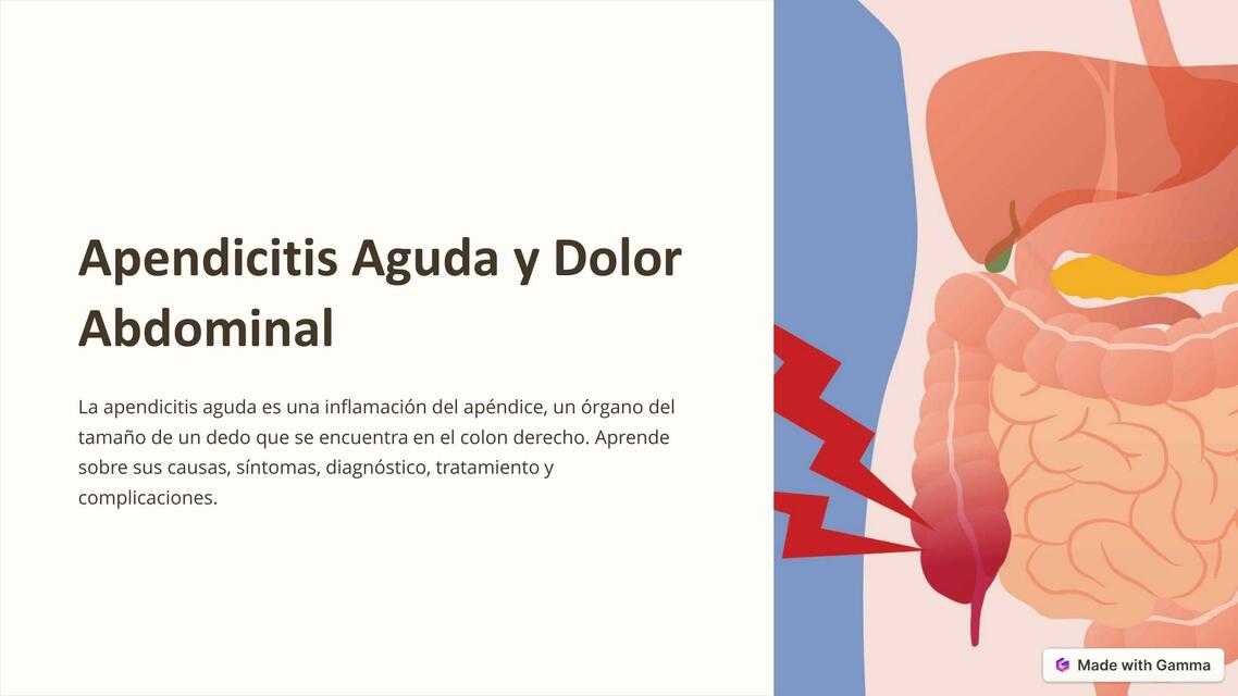 Apendicitis Aguda y Dolor Abdominal 