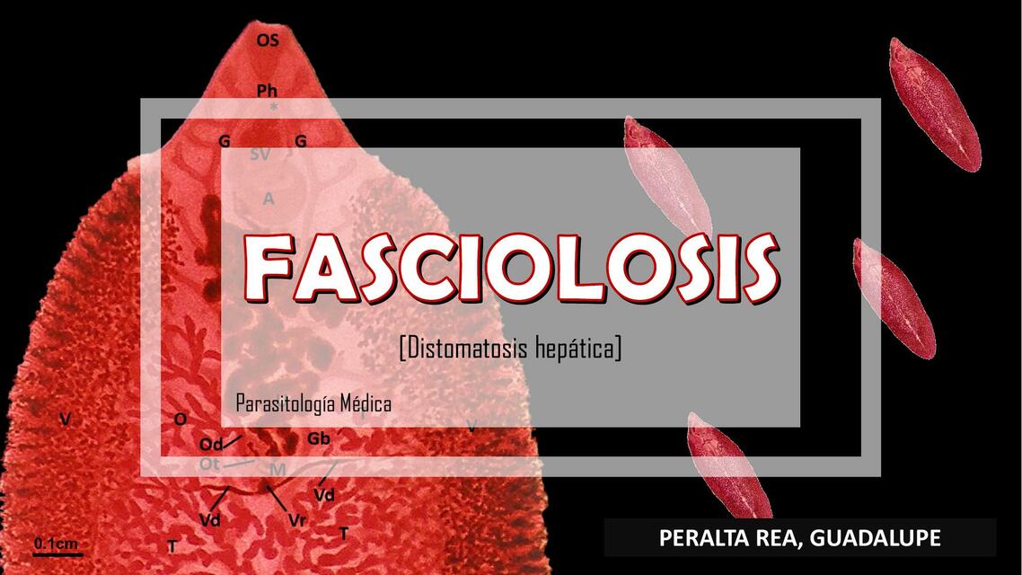 Fasciolosis 