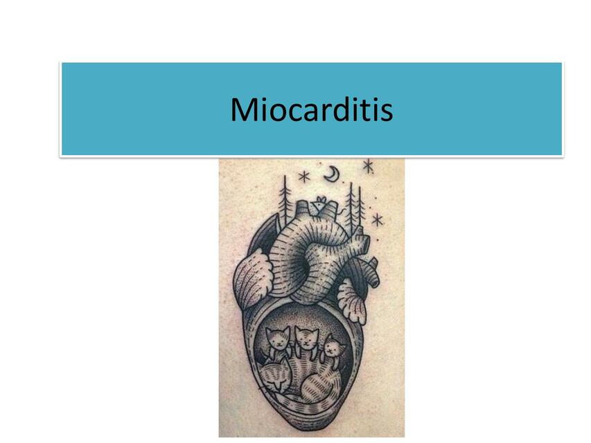 Miocarditis 