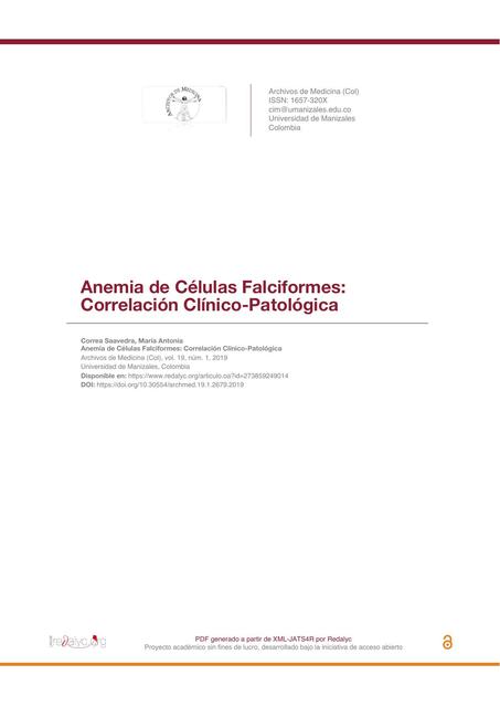 Anemia de Células Falciformes 