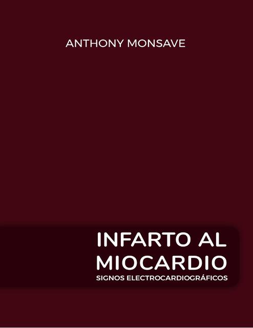 INFARTO AL MIOCARDIO SIGNOS ELECTROCARDIOGRÁFICOS