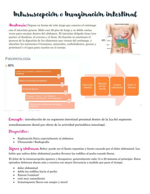 Intususcepcion intestinal