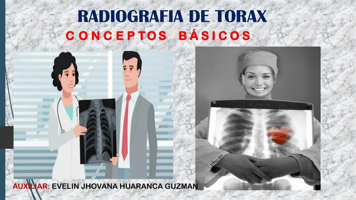 Radiografía de Tórax 