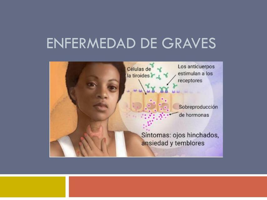 Enfermedad de graves 